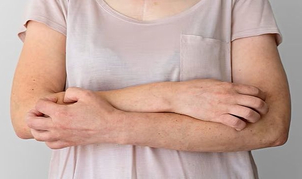 Bu hastalık kadınlarda 9 kat fazla görülüyor